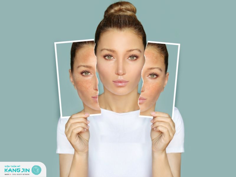 Lợi ích khi sử dụng Niacinamide cho làn da 