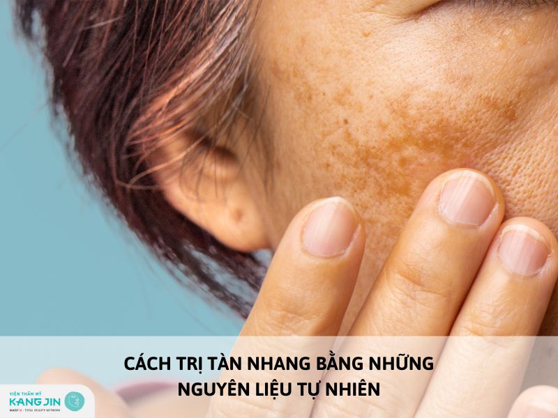cách trị tàn nhang