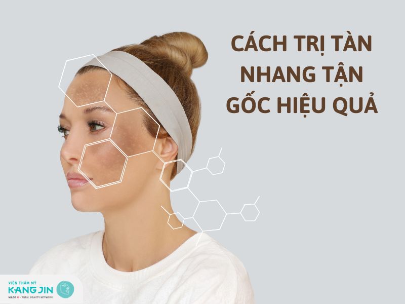 cách trị tàn nhang