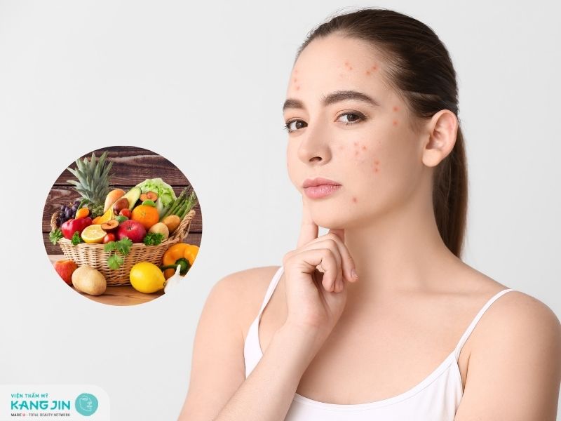 Tổng hợp các loại thức ăn đẹp da hết mụn bạn nên bổ sung vào thực đơn