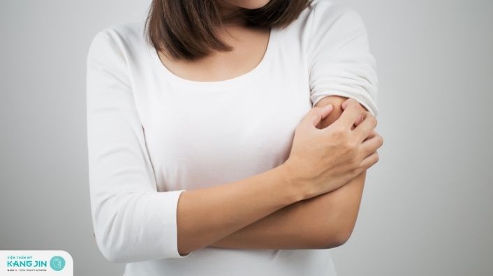 Cách trị viêm da dị ứng đơn giản ngay tại nhà