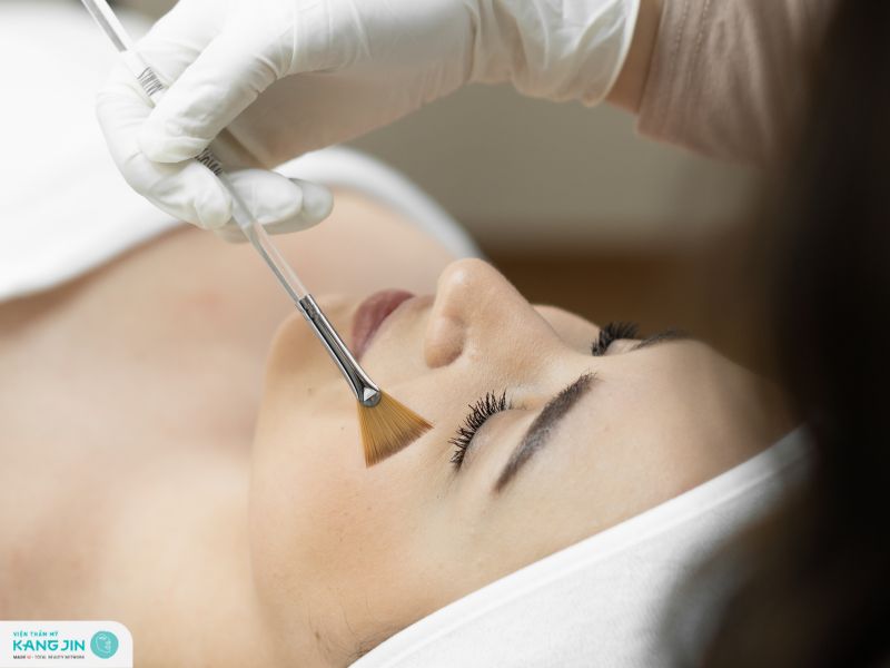 chăm sóc da sau peel