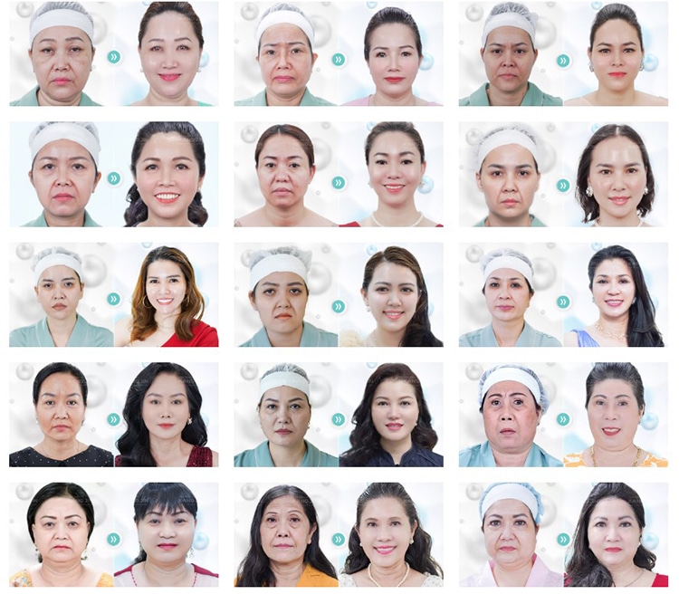 Viện thẩm mỹ KangJin có tốt không