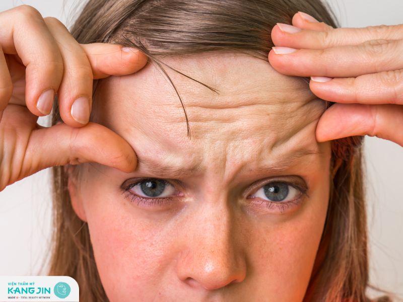 Tổng hợp các phương pháp làm giảm nếp nhăn trán phổ biến hiện nay 