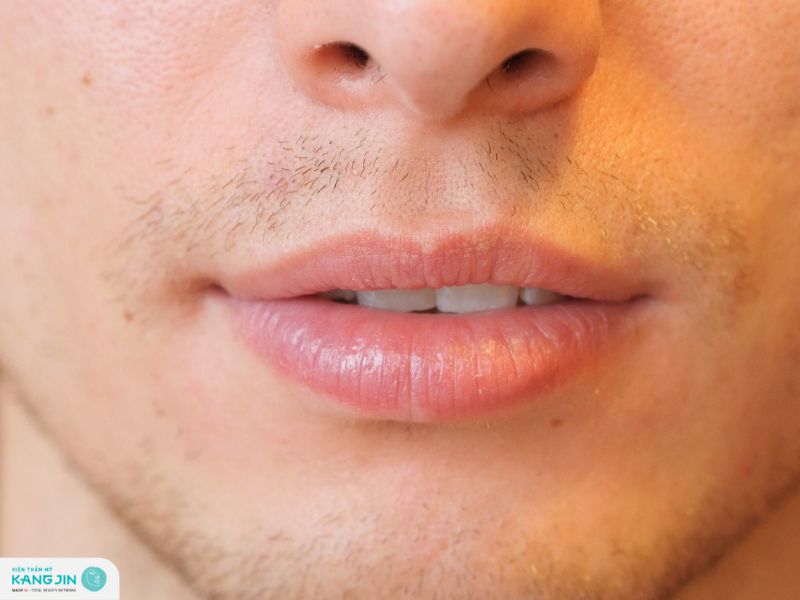 trị thâm môi cho nam