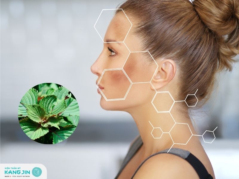 Cách trị nám bằng lá tía tô như thế nào?