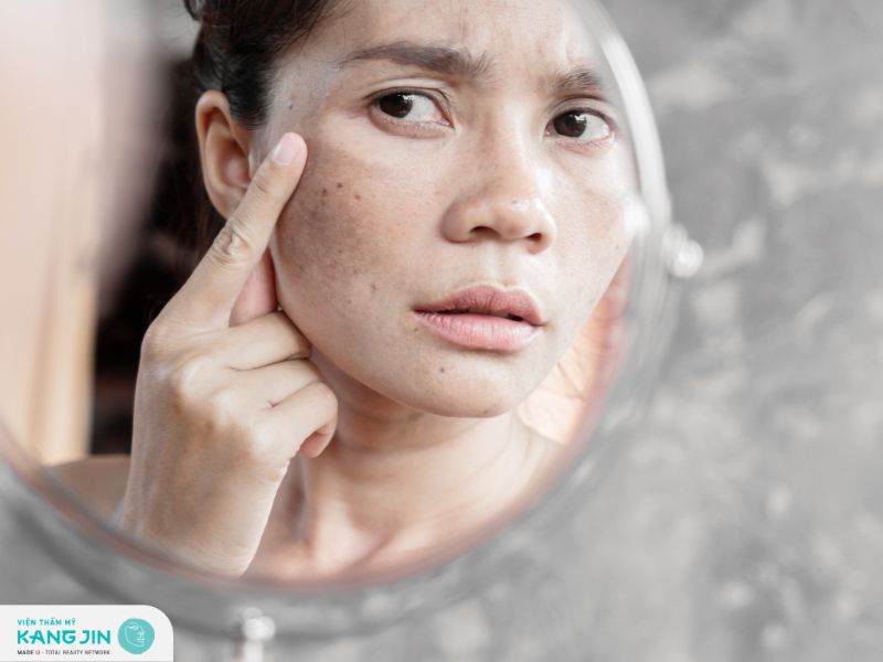 Hướng dẫn cách trị nám tại nhà bằng phương pháp tự nhiên hiệu quả 