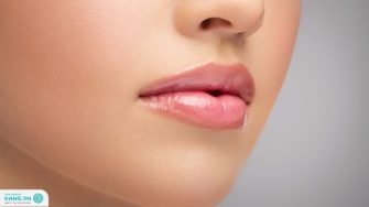 Cách trị thâm mép môi bằng nguyên liệu tự nhiên đơn giản tại nhà