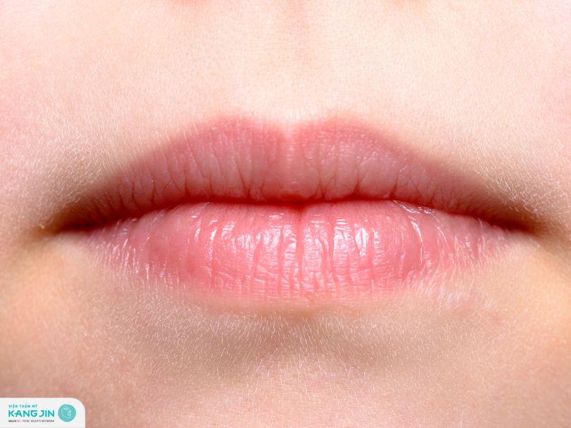 cách trị thâm mép môi