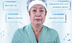 nsut-kim-phuong-truoc-khi-tham-my