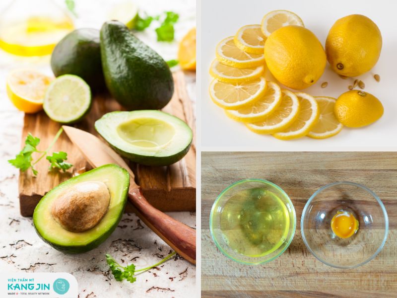 Kết hợp bơ, chanh và lòng trắng trứng gà tạo thành mặt nạ trị mụn tuyệt vời