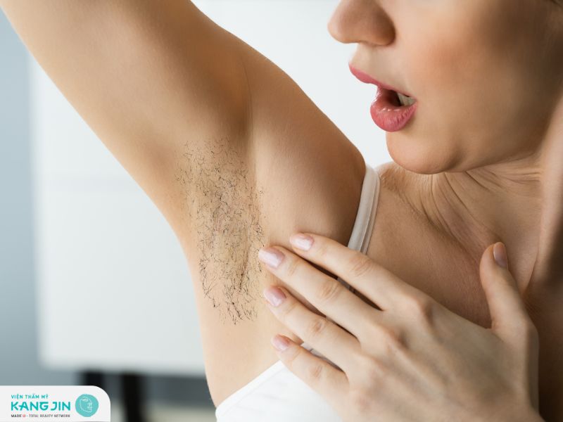 Sau khi sinh có tự hết thâm nách được hay không?