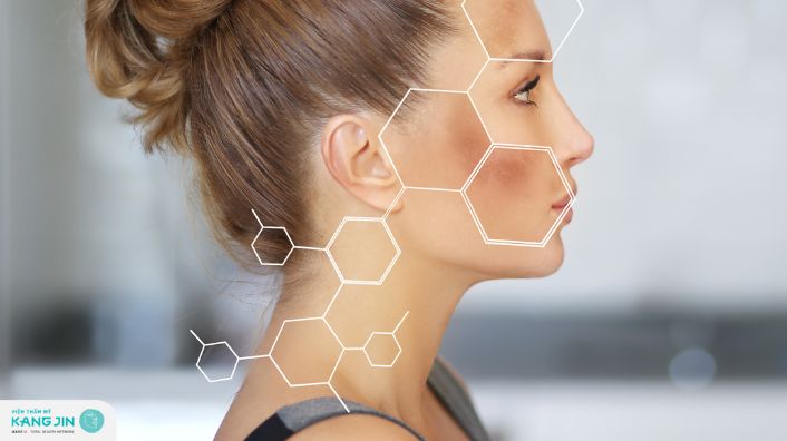 Tăng sắc tố da có nghĩa là gì? Cách điều trị hiệu quả tại nhà