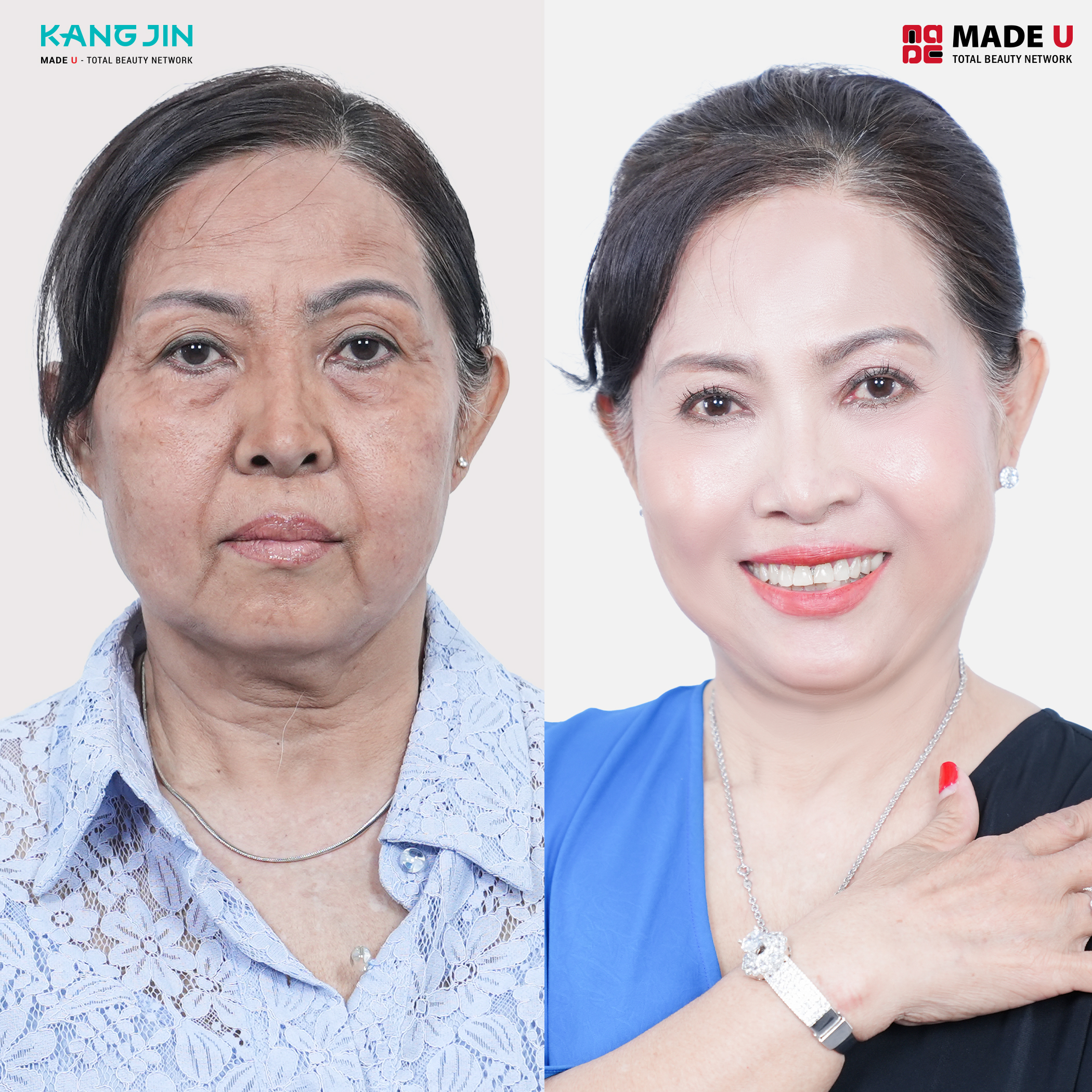 Khách hàng Hoàng Hậu (63 tuổi)