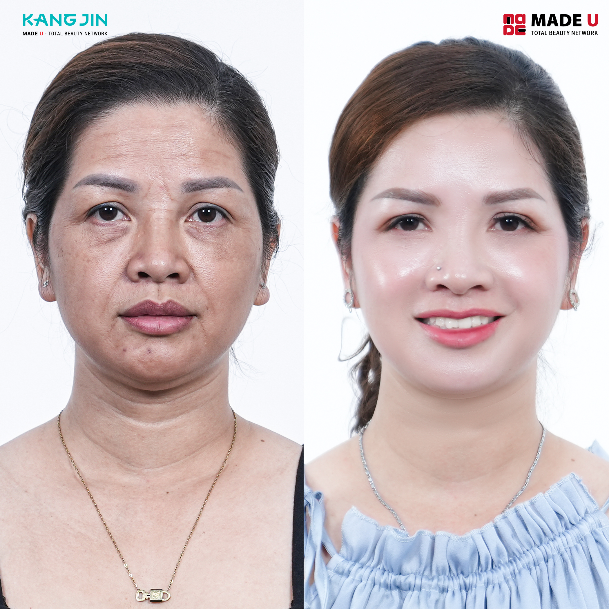 Khách hàng Kỳ Kỳ (43 tuổi)