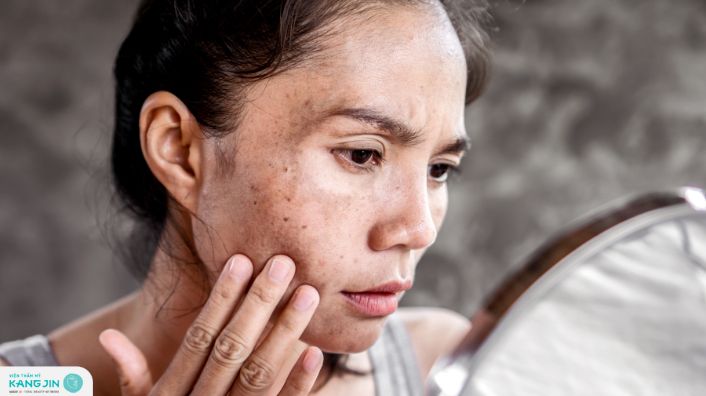 cách chăm sóc da bị nám