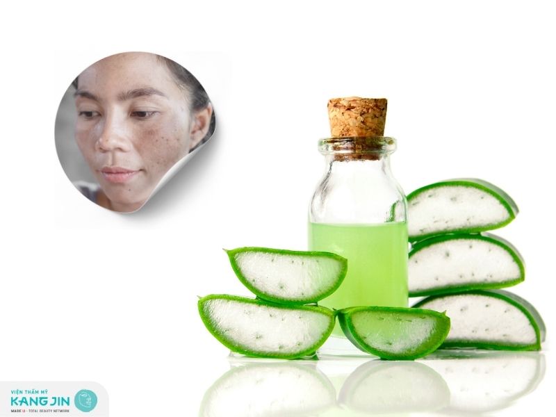 Tổng hợp các cách làm mặt nạ nha đam trị tàn nhang