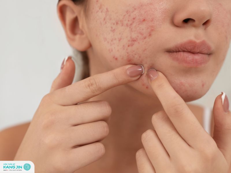 da mặt bị khô bong tróc phải làm sao