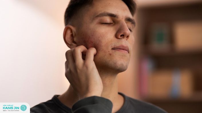 Nguyên nhân và cách khắc phục da mặt sạm đen ở nam giới