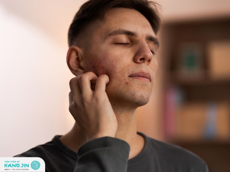 Da mặt sạm đen ở nam giới: Nguyên nhân và cách khắc phục