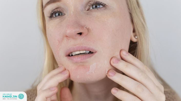 Tại sao da mặt sần sùi? Dấu hiệu và cách điều trị dứt điểm