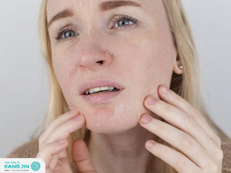 Tìm hiểu về nguyên nhân và cách điều trị da mặt sần sùi