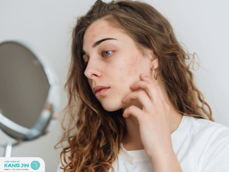 Da treatment là gì?