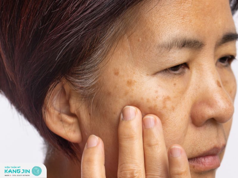 Các ảnh hưởng của da trong thời kỳ mãn kinh