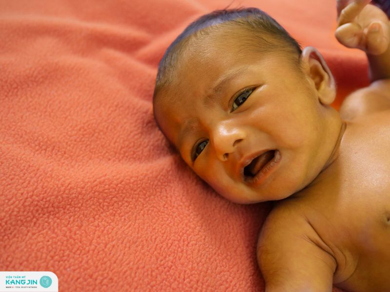 bệnh vàng da ở trẻ em