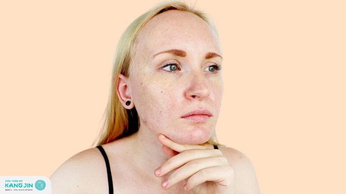 Nguyên nhân khiến da mỏng và cách khắc phục kịp thời