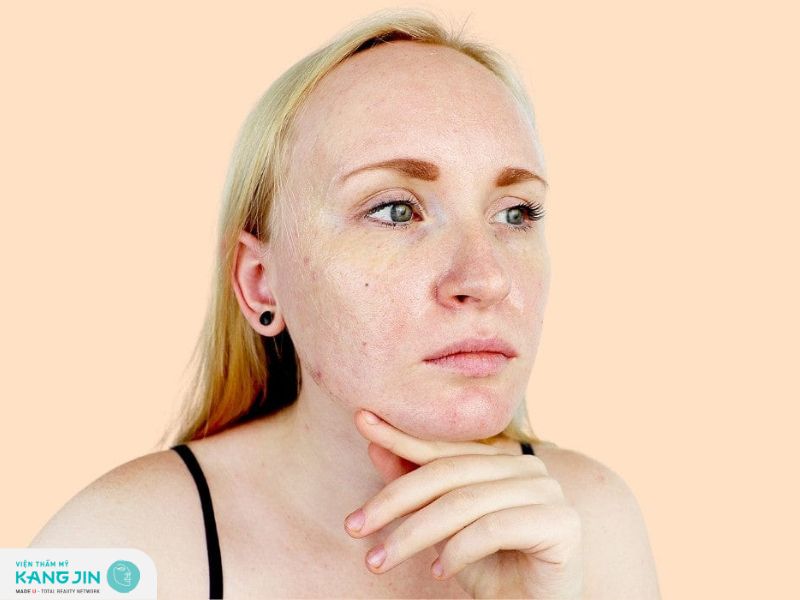 Những nguyên khiến da mỏng yếu dần theo thời gian và cách khắc phục