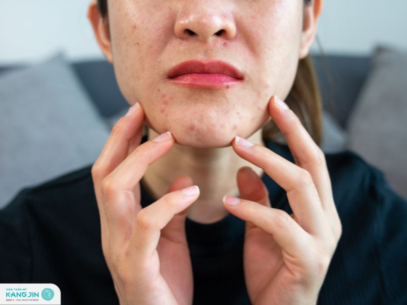 nhiễm trùng da do vi khuẩn