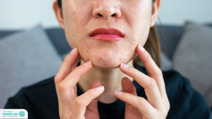 nhiễm trùng da do vi khuẩn