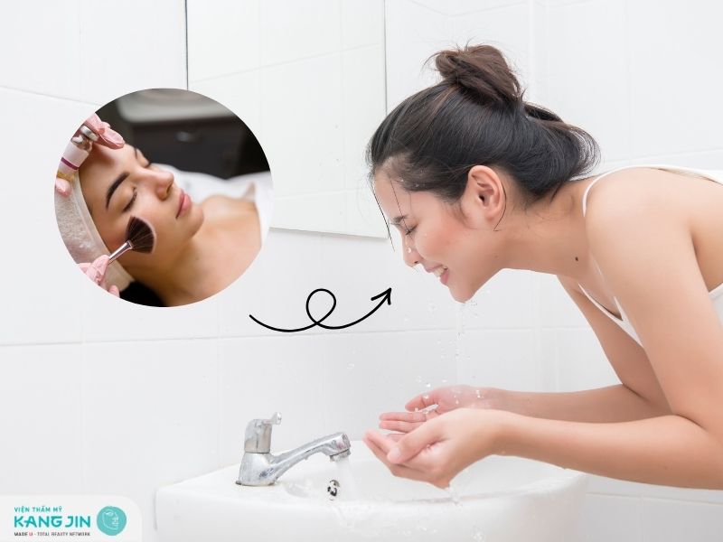 Peel da bao lâu thì rửa mặt?