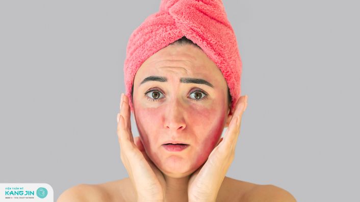 Nguyên nhân và cách xử lý tình trạng khi peel da bị bỏng