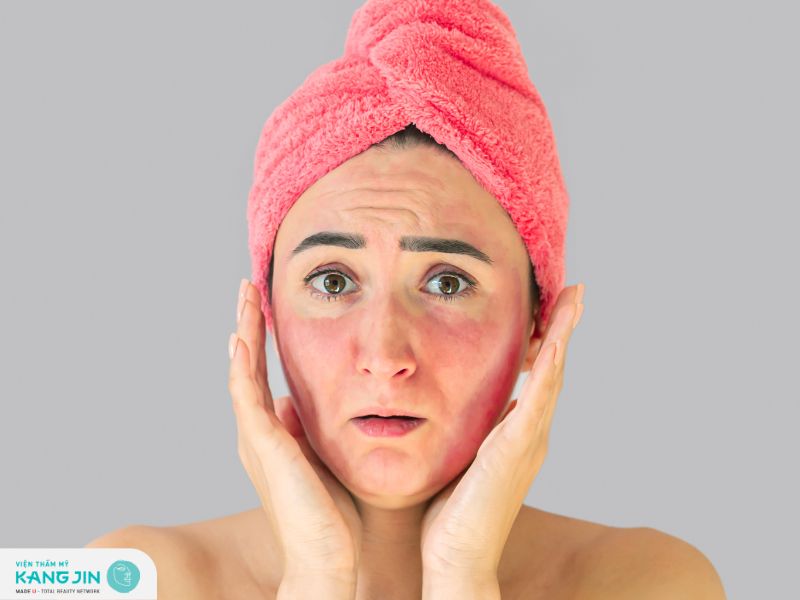 Peel da bị bỏng: Nguyên nhân, dấu hiệu nhận biết và cách khắc phục 