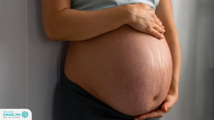 Nguyên nhân và cách phòng ngừa rạn da khi mang thai