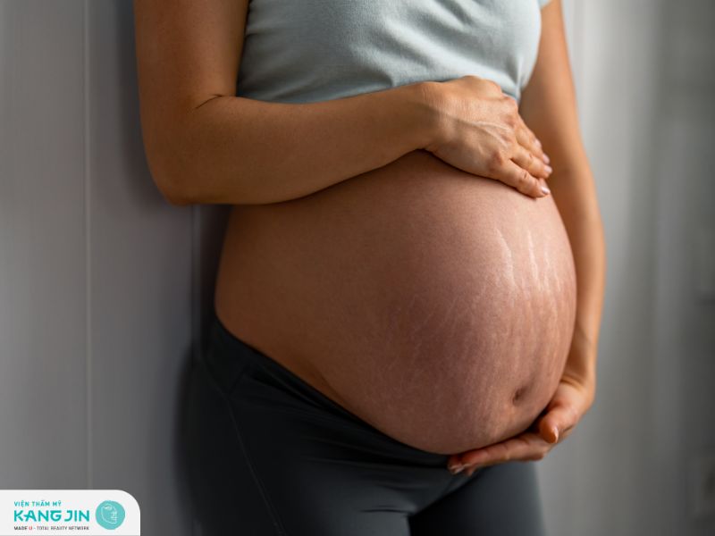 Tìm hiểu nguyên nhân và cách phòng ngừa rạn da khi mang thai