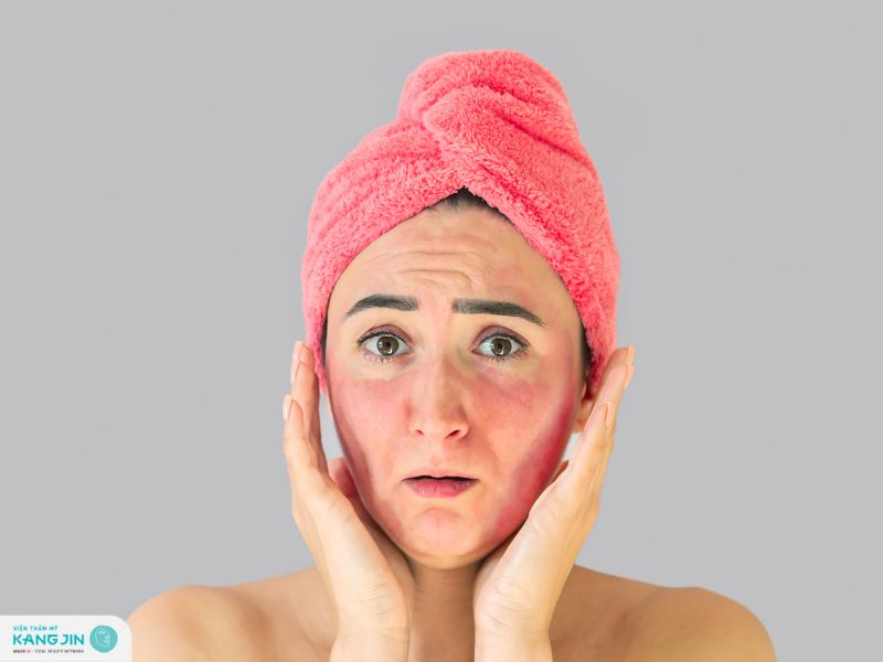 skincare cho da bị kích ứng