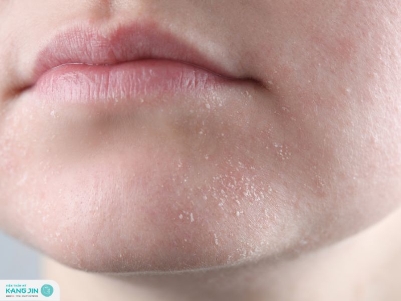 triệu chứng da mất nước