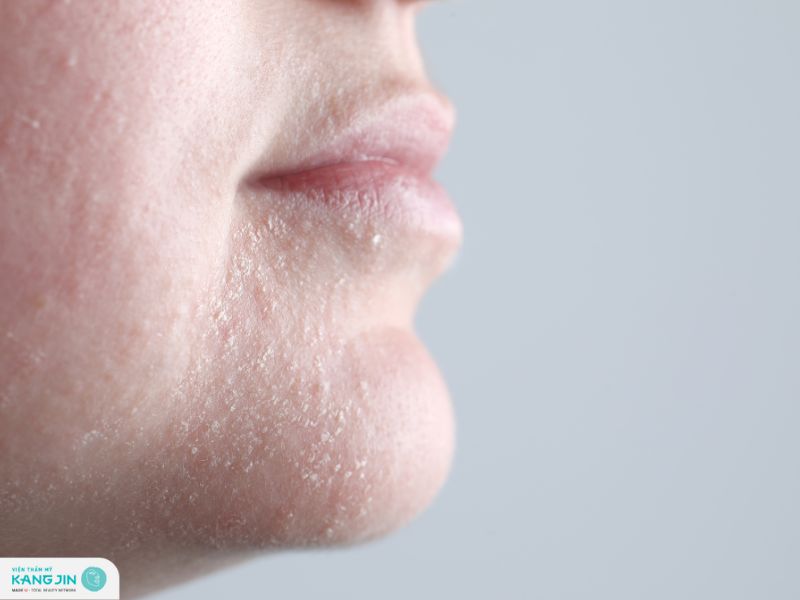 triệu chứng da mất nước