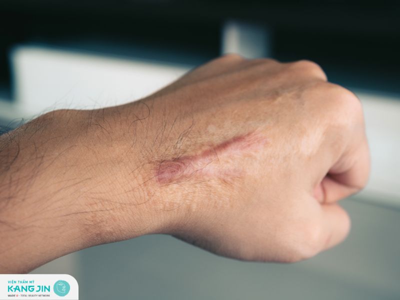 Những mẹo dân gian này có ưu nhược điểm gì?