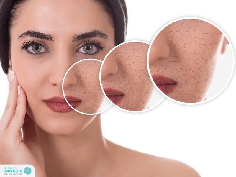 vì sao da khô nhanh lão hóa