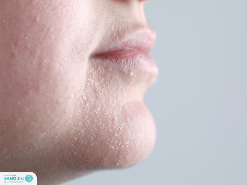 vì sao da khô nhanh lão hóa