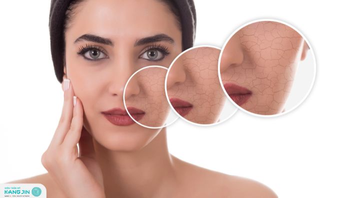 vì sao da khô nhanh lão hóa