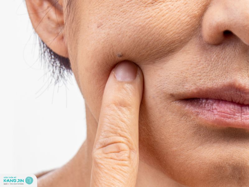 vùng nào dễ lão hóa