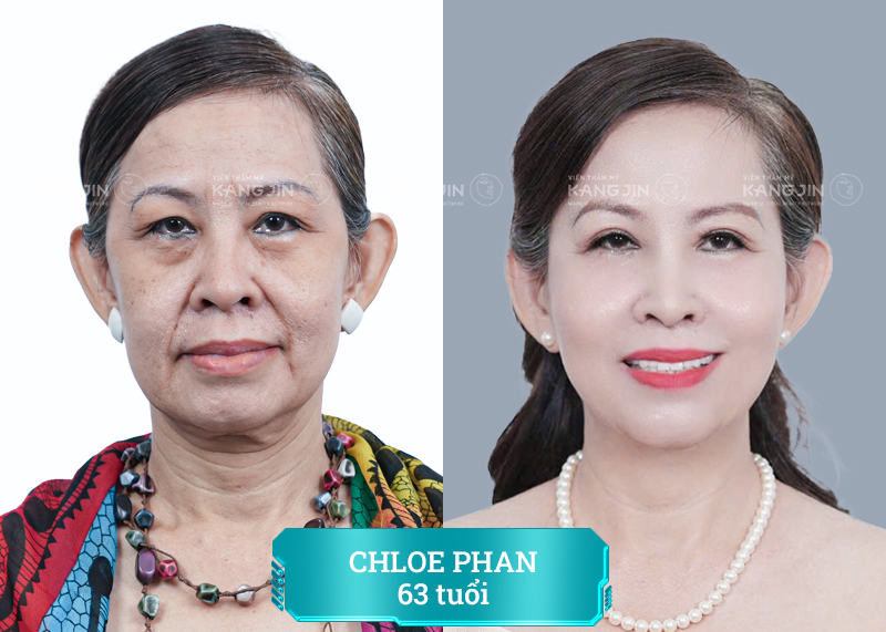 thay đổi của khách hàng