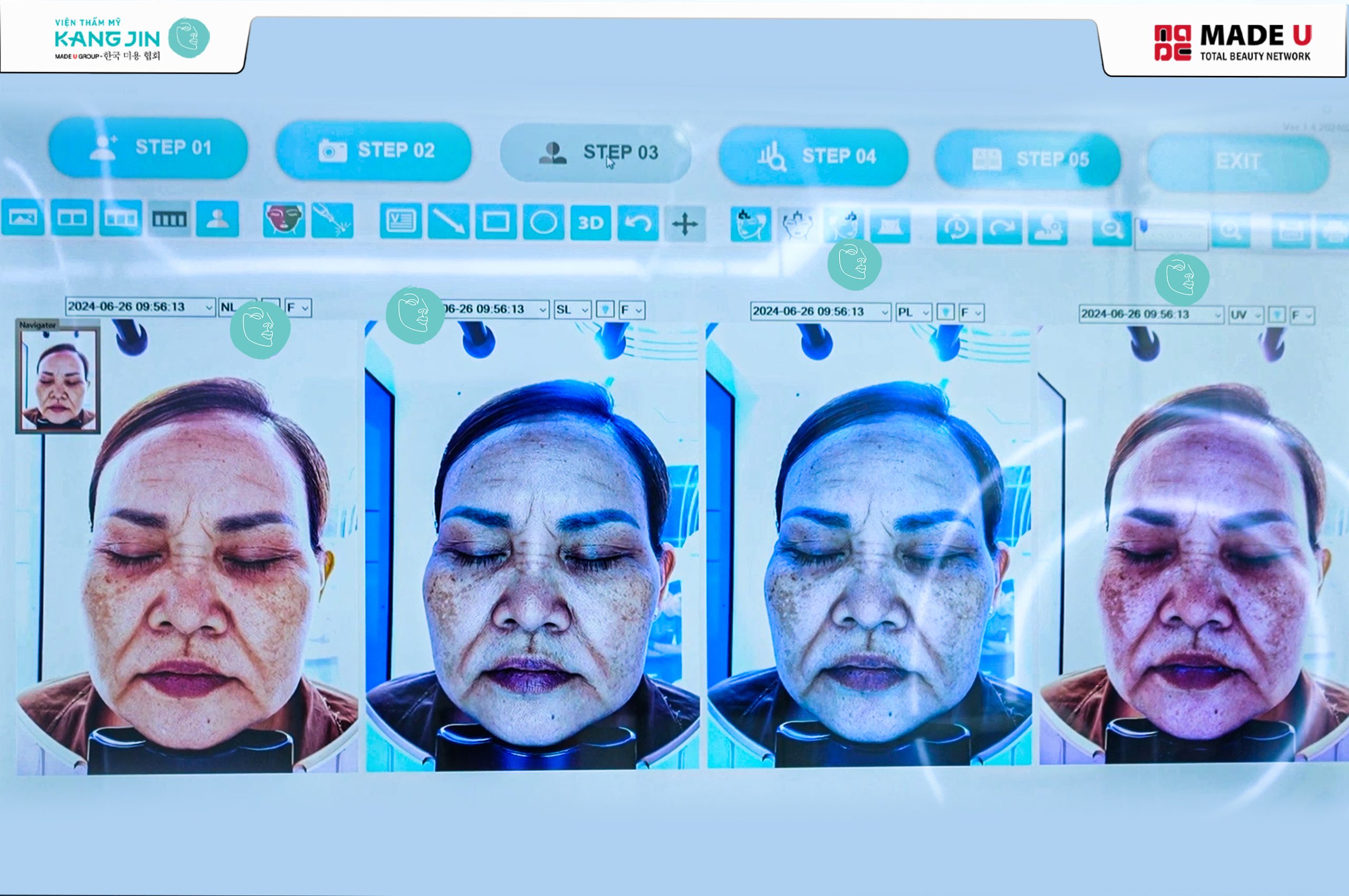 KH-Phuong-Ha-khi-phan-tich-bang-may-soi-da