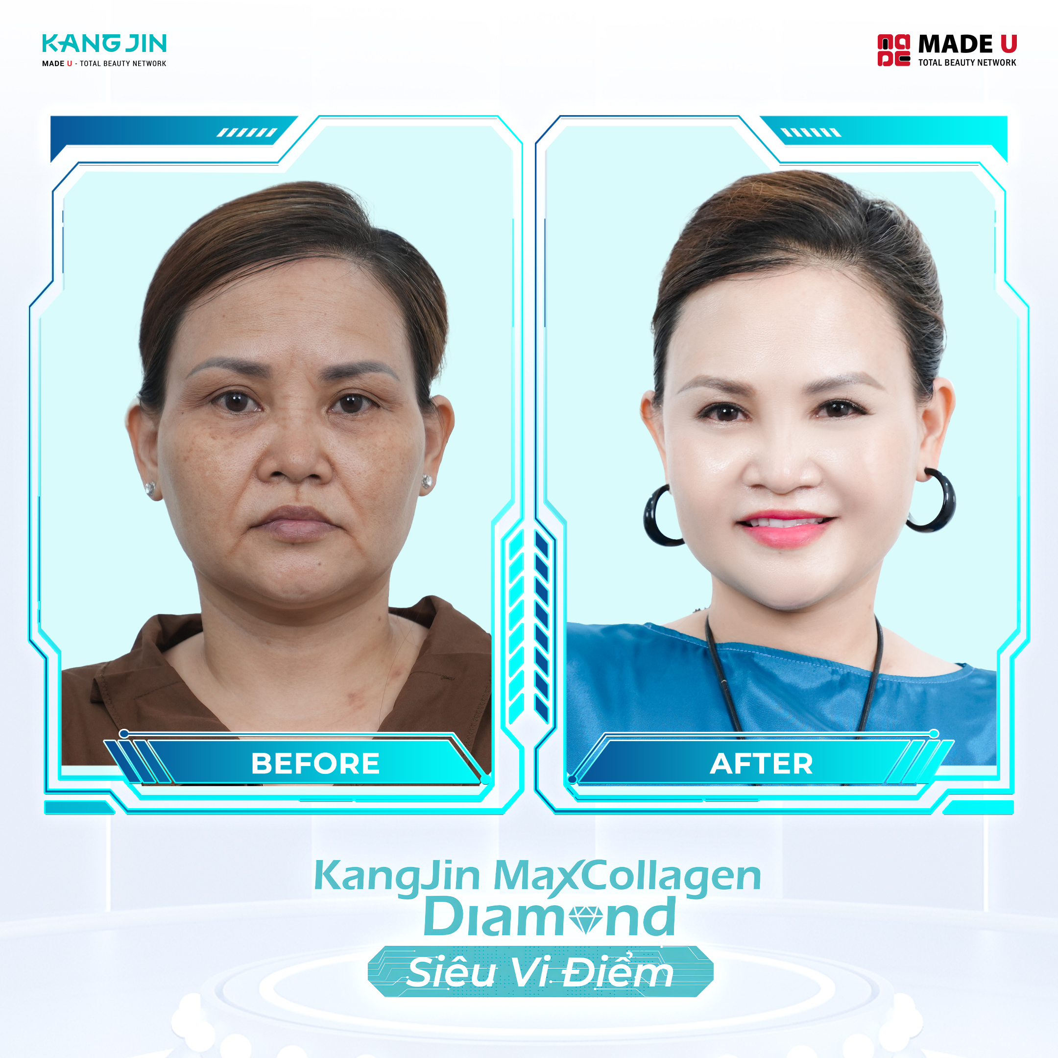 Khách hàng phương hà trước và sau khi đi khám