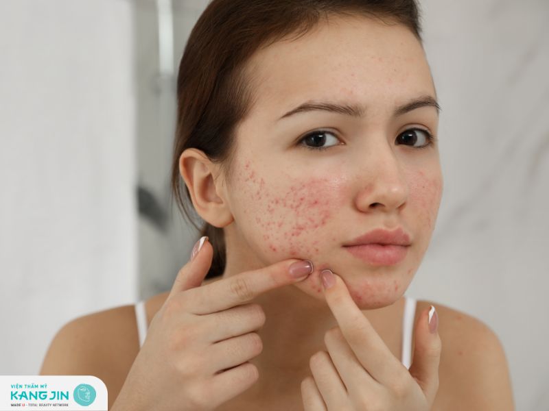 Ai không nên lăn kim?